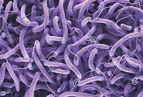 Niger State records 100 cholera deaths – Commissioner